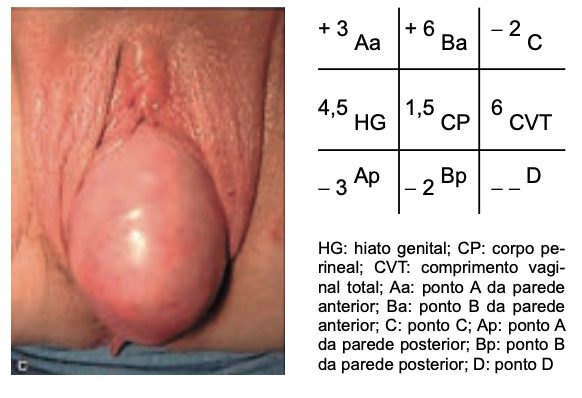 Figura da questão 24 da HCPA 2022