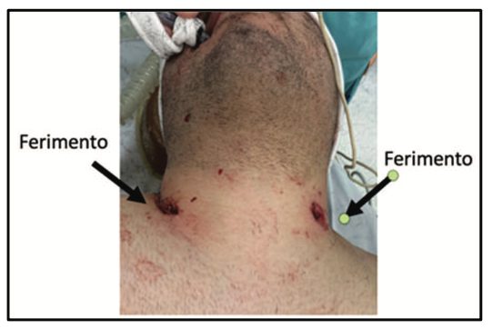 Figura da questão 31 da USP-SP 2024