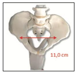 Figura da questão 110 da USP-SP 2024
