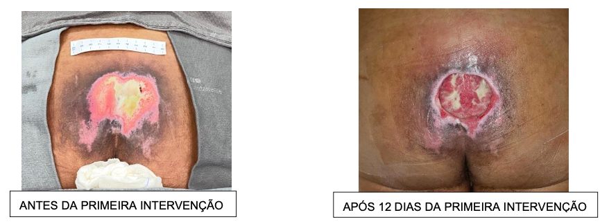 Figura da questão 88 da USP-SP 2021